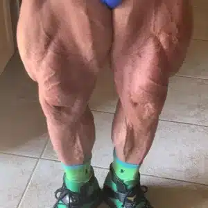 tomplatz legs